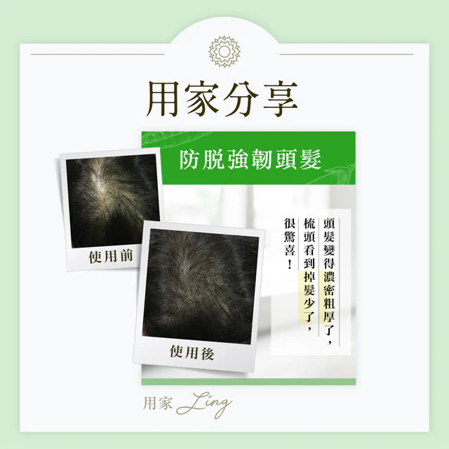 《防脫x生髮》套裝
